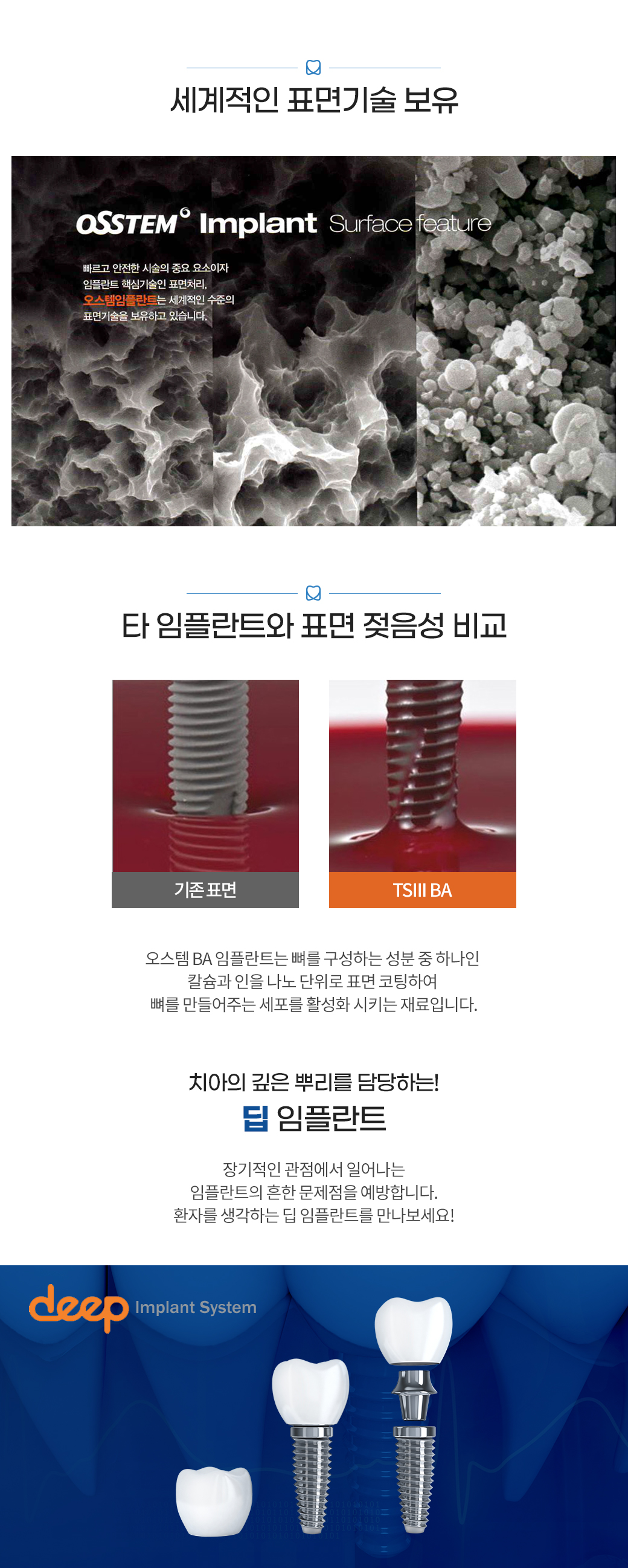 네비게이션 임플란트 - 컴퓨터 유도 시스템을 통한 정밀 임플란트 수술