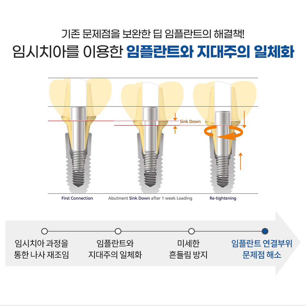 당일 임플란트 - 발치 후 즉시 식립하는 빠른 임플란트 시술