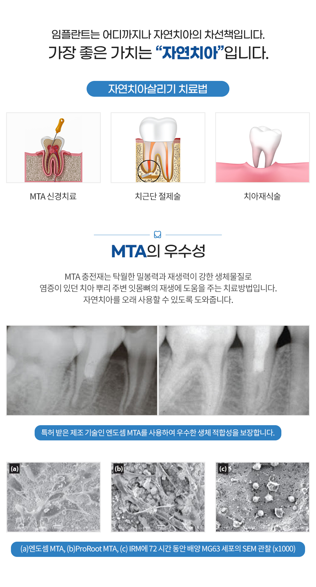 치아미백 - 전문의가 직접 진행하는 치아미백