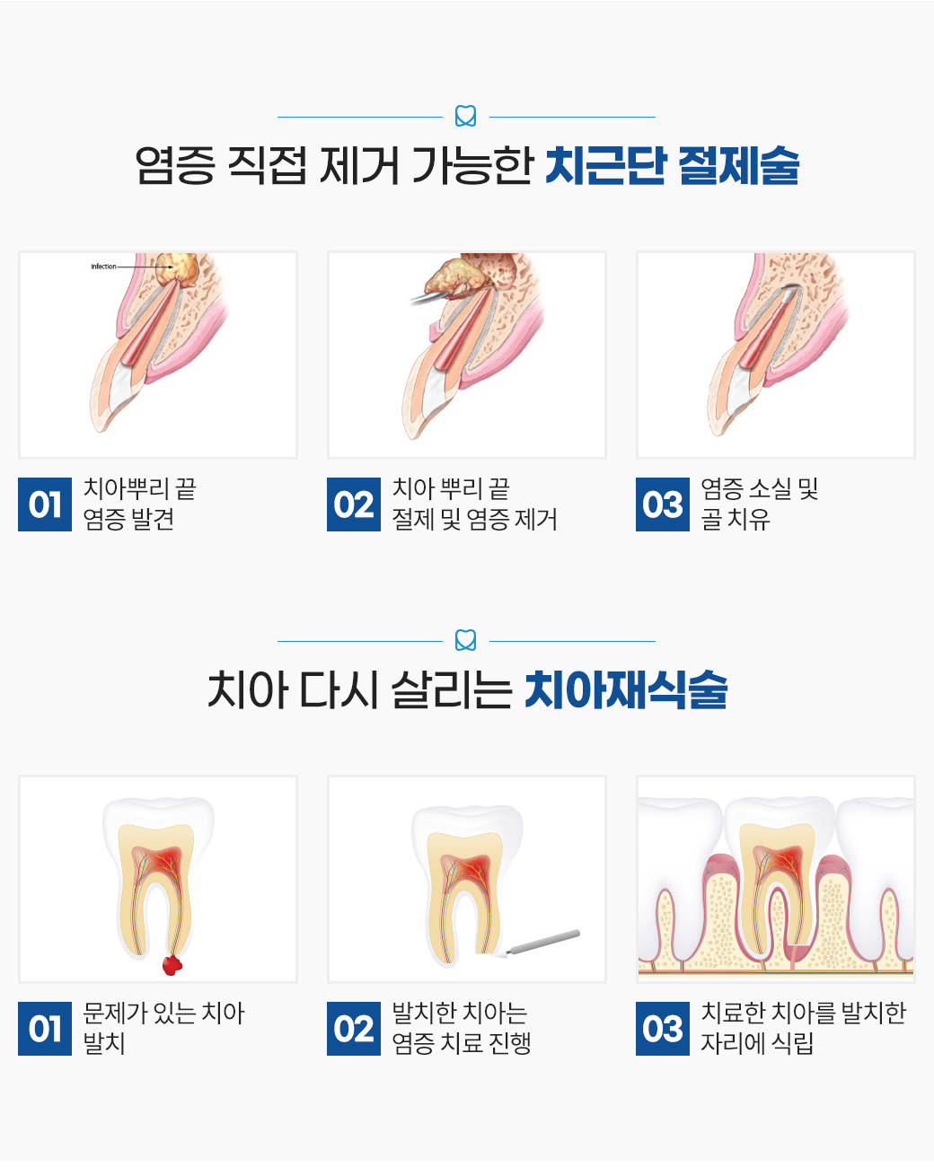 무통 마취 - 덜 아픈 진료를 위한 노력