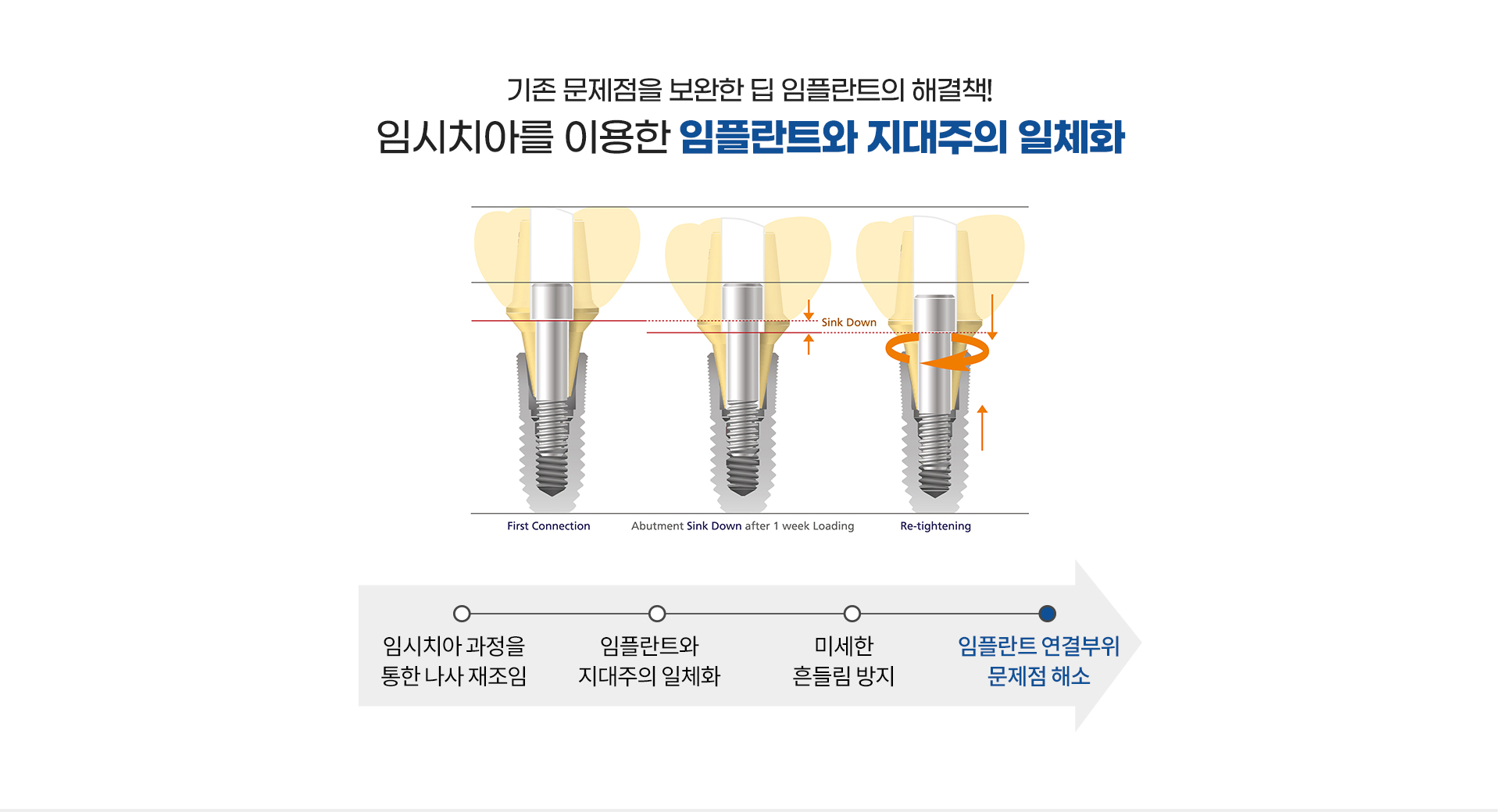당일 임플란트 - 발치 후 즉시 식립하는 빠른 임플란트 시술