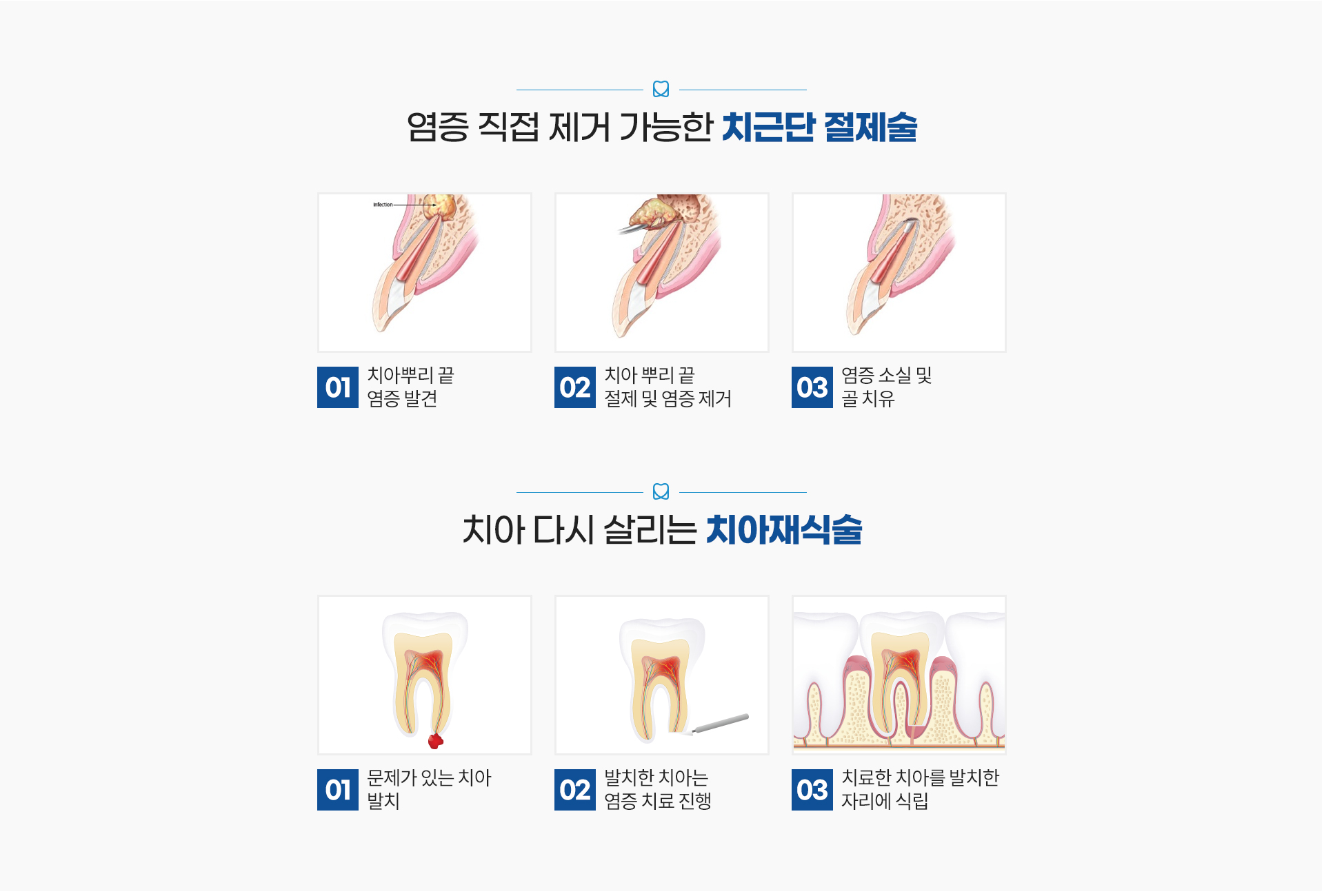 무통 마취 - 덜 아픈 진료를 위한 노력